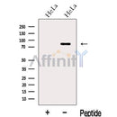 Western blot analysis of extracts from HeLa cells, using LCA5 Antibody. The lane on the left was treated with blocking peptide.