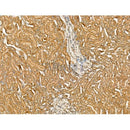 Nav1.8 Antibody -DF13241