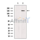SCC112 Antibody -DF13456