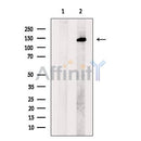 SALL1 Antibody -DF13458