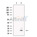 TECK Antibody -DF13462