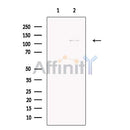 HIRA Antibody -DF13473