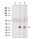 AK2 Antibody -DF13478