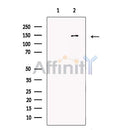 MTR Antibody -DF13489