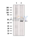 KCNK9 Antibody -DF13498