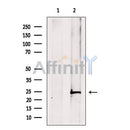ATP6V1E1 Antibody -DF13510