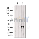 NAT14 Antibody -DF13526