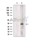 SET Antibody -DF13529