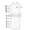 GP210 Antibody -DF13536