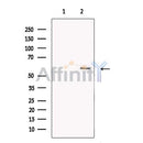 Glucose Transporter 5 GLUT5 Antibody -DF13545