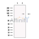 Guanylyl Cyclase alpha 2 Antibody -DF13547