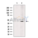 SERPINB1 Antibody -DF13548