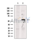 Ornithine Carbamoyltransferase Antibody -DF13552
