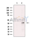 PITX2 Antibody -DF13574