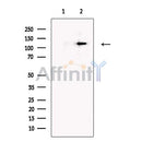 PTCH2 Antibody -DF13589