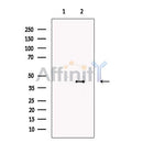 Lefty Antibody -DF13617