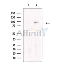 Glycogen synthase 2 Antibody -DF13655