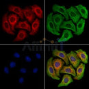 CD64 Antibody -DF13670
