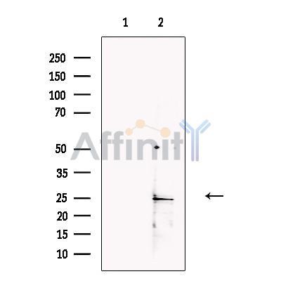 Placental lactogen Antibody -DF13739