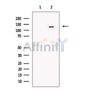 SMC5 Antibody -DF13744