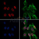 DF3142 at 1/100 staining Human lung tissue by IHC-P. The sample was formaldehyde fixed and a heat mediated antigen retrieval step in citrate buffer was performed. The sample was then blocked and incubated with the antibody for 1.5 hours at 22¡ãC. An HRP conjugated goat anti-rabbit antibody was used as the secondary