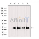 Western blot analysis of extracts from various samples, using RPL19 Antibody.
Lane 1: Rat brain, treated with blocking peptide;
Lane 2: Rat brain;
Lane 3: Hybridoma cells;
Lane 4: Mouse lung;
Lane 5: 293.
