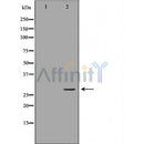 DF6186 at 1/100 staining Mouse heart tissue by IHC-P. The sample was formaldehyde fixed and a heat mediated antigen retrieval step in citrate buffer was performed. The sample was then blocked and incubated with the antibody for 1.5 hours at 22¡ãC. An HRP conjugated goat anti-rabbit antibody was used as the secondary