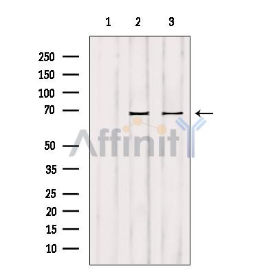 Western blot analysis of extracts from various samples, using GCKR Antibody.
 Lane 1: mouse lung treated with blocking peptide.
 Lane 2: mouse lung;
 Lane 3: HUVEC;
 