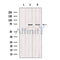 Western blot analysis of extracts from various samples, using GCKR Antibody.
 Lane 1: mouse lung treated with blocking peptide.
 Lane 2: mouse lung;
 Lane 3: HUVEC;
 
