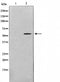 AF0725 staining HeLa by IF/ICC. The sample were fixed with PFA and permeabilized in 0.1% Triton X-100,then blocked in 10% serum for 45 minutes at 25¡ãC. The primary antibody was diluted at 1/200 and incubated with the sample for 1 hour at 37¡ãC. An  Alexa Fluor 594 conjugated goat anti-rabbit IgG (H+L) Ab, diluted at 1/600, was used as the secondary antibod