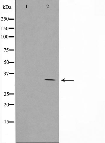 AF0678 staining Hela by IF/ICC. The sample were fixed with PFA and permeabilized in 0.1% Triton X-100,then blocked in 10% serum for 45 minutes at 25¡ãC. The primary antibody was diluted at 1/200 and incubated with the sample for 1 hour at 37¡ãC. An  Alexa Fluor 594 conjugated goat anti-rabbit IgG (H+L) Ab, diluted at 1/600, was used as the secondary antibod