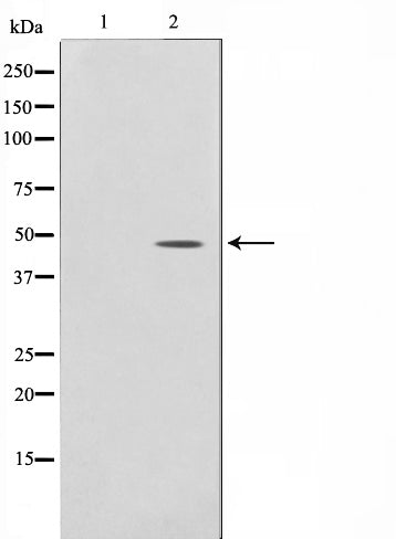 AF0570 staining LOVO by IF/ICC. The sample were fixed with PFA and permeabilized in 0.1% Triton X-100,then blocked in 10% serum for 45 minutes at 25¡ãC. The primary antibody was diluted at 1/200 and incubated with the sample for 1 hour at 37¡ãC. An  Alexa Fluor 594 conjugated goat anti-rabbit IgG (H+L) Ab, diluted at 1/600, was used as the secondary antibod