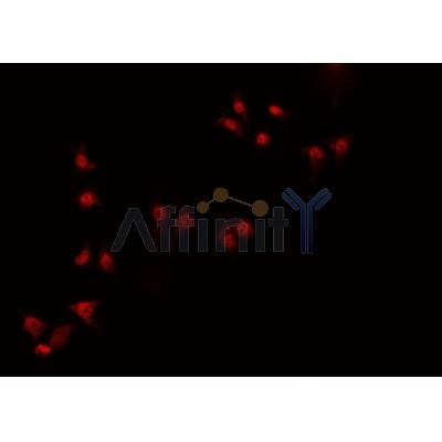 Western blot analysis of extracts from rat heart, using ZNF174 Antibody. Lane 1 was treated with the blocking peptide.