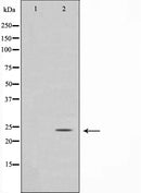 Western blot analysis on COS7 cell lysate using Glucagon Antibody,The lane on the left is treated with the antigen-specific peptide.