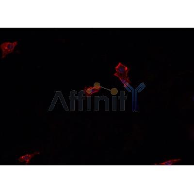 AF0166 staining U-2 OS cells by IF/ICC. The sample were fixed with PFA and permeabilized in 0.1% Triton X-100,then blocked in 10% serum for 45 minutes at 25¡ãC. The primary antibody was diluted at 1/200 and incubated with the sample for 1 hour at 37¡ãC. An  Alexa Fluor 594 conjugated goat anti-rabbit IgG (H+L) antibody(Cat.