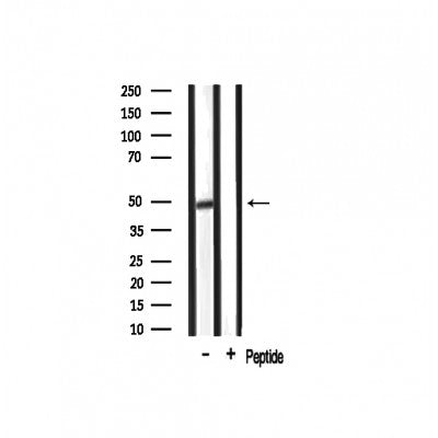 AF0723 staining Hela by IF/ICC. The sample were fixed with PFA and permeabilized in 0.1% Triton X-100,then blocked in 10% serum for 45 minutes at 25¡ãC. The primary antibody was diluted at 1/200 and incubated with the sample for 1 hour at 37¡ãC. An  Alexa Fluor 594 conjugated goat anti-rabbit IgG (H+L) Ab, diluted at 1/600, was used as the secondary antibod