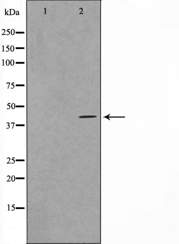 Western blot analysis on RAW264.7 cell lysate using VPS72 Antibody,The lane on the left is treated with the antigen-specific peptide.