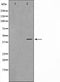 Western blot analysis on RAW264.7 cell lysate using VPS72 Antibody,The lane on the left is treated with the antigen-specific peptide.