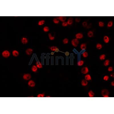 AF0508 staining RAW264.7 by IF/ICC. The sample were fixed with PFA and permeabilized in 0.1% Triton X-100,then blocked in 10% serum for 45 minutes at 25¡ãC. The primary antibody was diluted at 1/200 and incubated with the sample for 1 hour at 37¡ãC. An  Alexa Fluor 594 conjugated goat anti-rabbit IgG (H+L) Ab, diluted at 1/600, was used as the secondary antibod