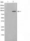 AF0636 staining MCF-7 cells by IF/ICC. The sample were fixed with PFA and permeabilized in 0.1% Triton X-100,then blocked in 10% serum for 45 minutes at 25¡ãC. The primary antibody was diluted at 1/200 and incubated with the sample for 1 hour at 37¡ãC. An  Alexa Fluor 594 conjugated goat anti-rabbit IgG (H+L) antibody(Cat.