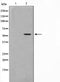 AF0647 staining Hela by IF/ICC. The sample were fixed with PFA and permeabilized in 0.1% Triton X-100,then blocked in 10% serum for 45 minutes at 25¡ãC. The primary antibody was diluted at 1/200 and incubated with the sample for 1 hour at 37¡ãC. An  Alexa Fluor 594 conjugated goat anti-rabbit IgG (H+L) Ab, diluted at 1/600, was used as the secondary antibod