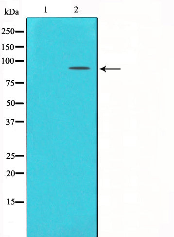 Western blot analysis on mouse brain cell lysate using mGluR2/3 Antibody,The lane on the left is treated with the antigen-specific peptide.