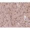 AF0167 at 1/200 staining human brain tissue sections by IHC-P. The tissue was formaldehyde fixed and a heat mediated antigen retrieval step in citrate buffer was performed. The tissue was then blocked and incubated with the antibody for 1.5 hours at 22¡ãC. An HRP conjugated goat anti-rabbit antibody was used as the secondary