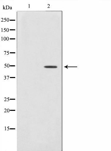 Western blot analysis on Jurkat cell lysate using PLCH Antibody