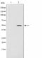 Western blot analysis on Jurkat cell lysate using PLCH Antibody