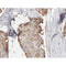 Western blot analysis of extracts from HepG2, using PHLA2 Antibody. Lane 1 was treated with the antigen-specific peptide.