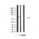 Western blot analysis of extracts from HepG2, using SGOL1 Antibody.