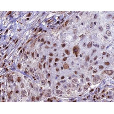Western blot analysis of extracts from rat brain, using CDKL4 Antibody.
