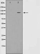 AF0596 staining HT29 by IF/ICC. The sample were fixed with PFA and permeabilized in 0.1% Triton X-100,then blocked in 10% serum for 45 minutes at 25¡ãC. The primary antibody was diluted at 1/200 and incubated with the sample for 1 hour at 37¡ãC. An  Alexa Fluor 594 conjugated goat anti-rabbit IgG (H+L) Ab, diluted at 1/600, was used as the secondary antibod