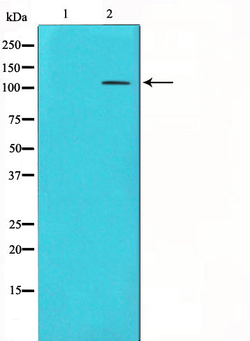 Western blot analysis on 293 cell lysate using mGluR4 Antibody,The lane on the left is treated with the antigen-specific peptide.